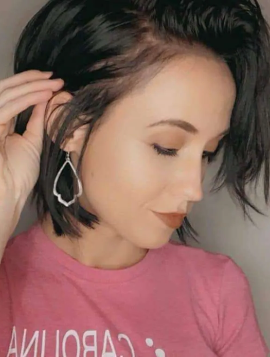 SMP for women adding natural-looking density to thinning hair